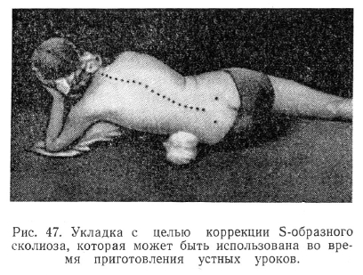 Укладка с целью коррекции S-образного  сколиоза, которая может быть использована во время приготовления устных уроков